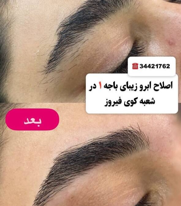 اصلاح ابرو